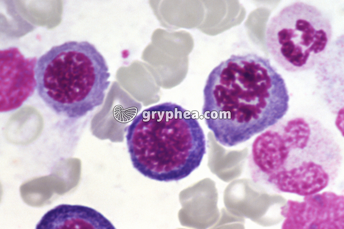 Moelle osseuse humaine cellules en mitose - prophase x400 - gryphea.com